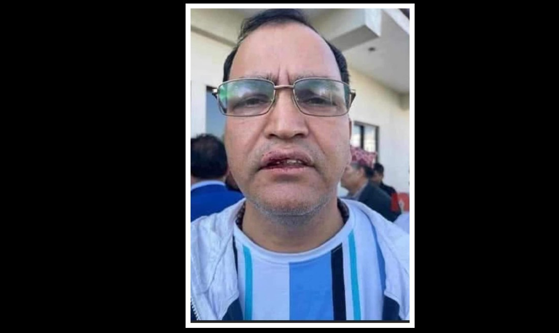 एनआरएन कार्यालयमा पत्रकारमाथि हातपात, महासंघद्वारा छानबिन माग